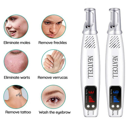 Effective At Home Laser Tattoo Remover Pen