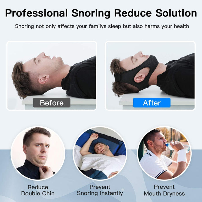 Soft Anti Snore Chin Strap for Better Sleep