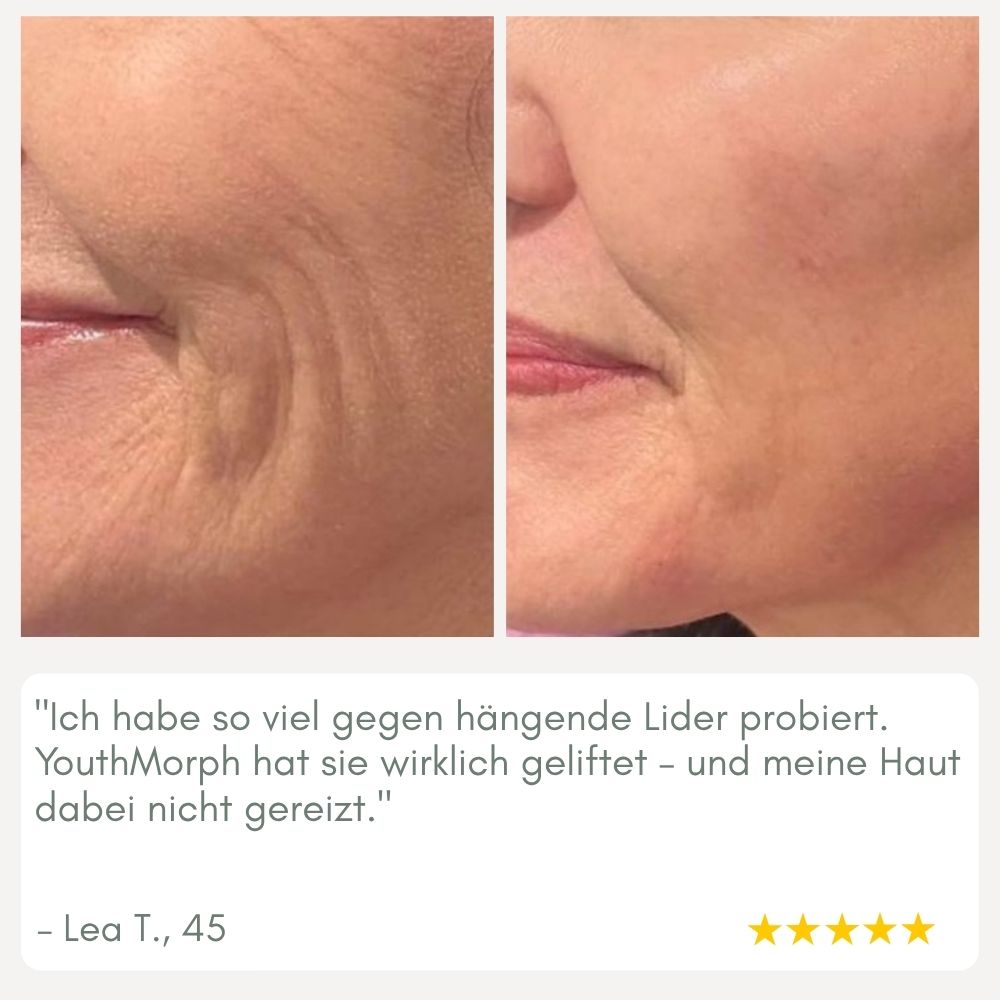 Instant Face Lift Cream for Younger Looking Skin