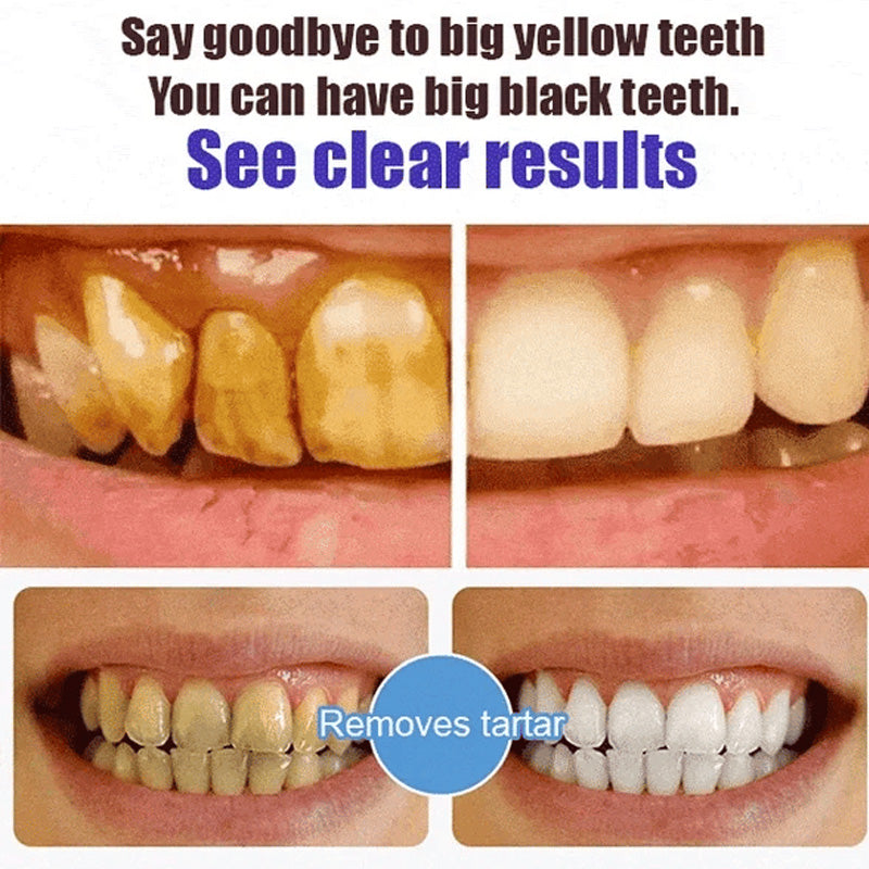 Natural Whitening Probiotic Toothpaste