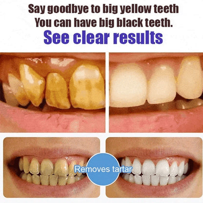 Natural Whitening Probiotic Toothpaste