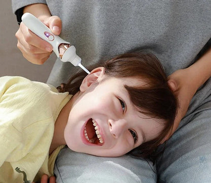 Easy Ear Cleaner Tool - Safe and Gentle Ear Wax Removal - Fesara