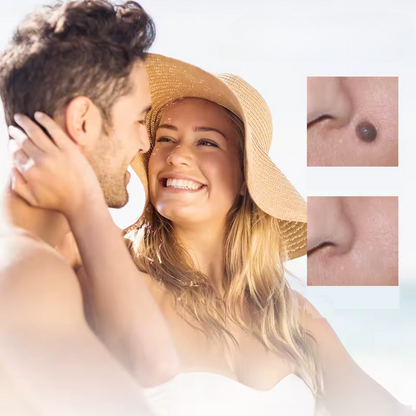 Fast Acting Wart Removal Cream