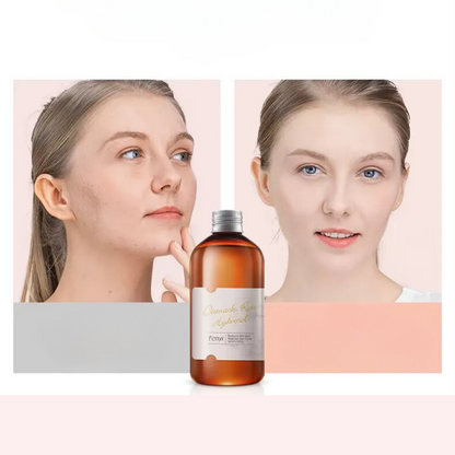 Hydrating Rose Toner for Sensitive Skin Care