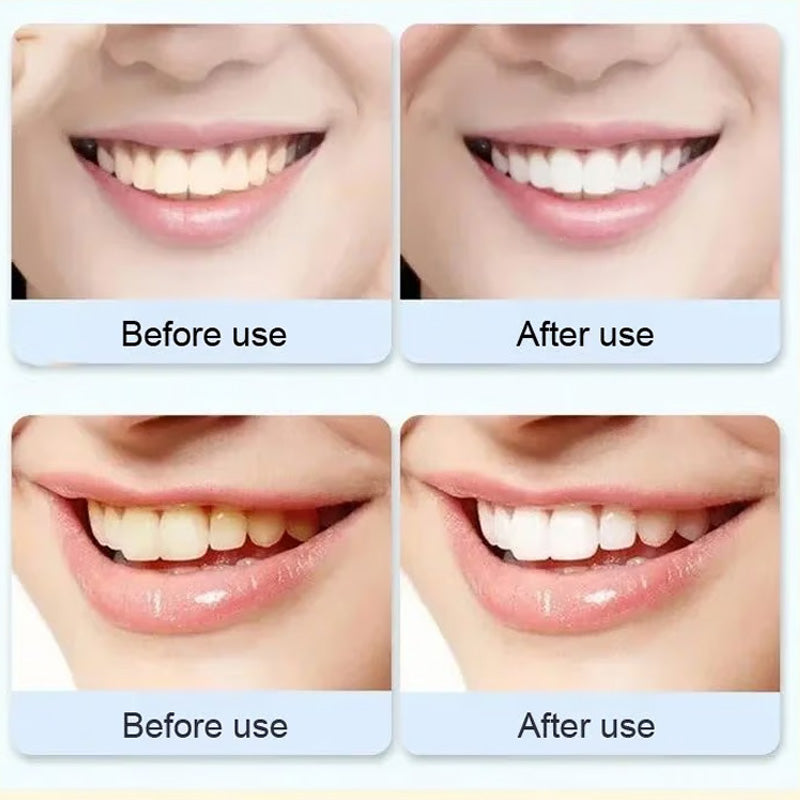Natural Whitening Probiotic Toothpaste