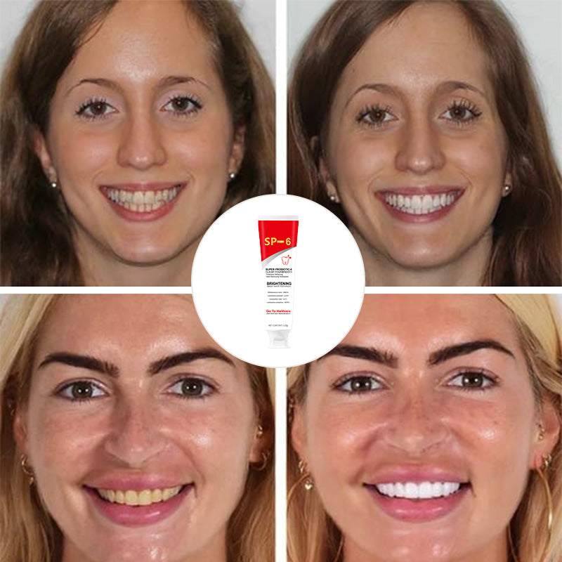 Natural Whitening Probiotic Toothpaste