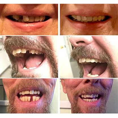 Premium Dental False Teeth Set