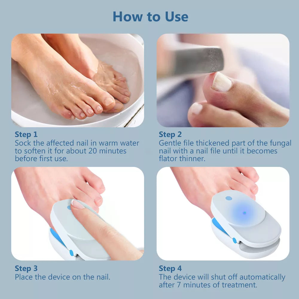 Advanced Fungal Nail Laser Treatment Device