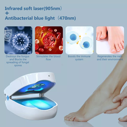 Advanced Fungal Nail Laser Treatment Device