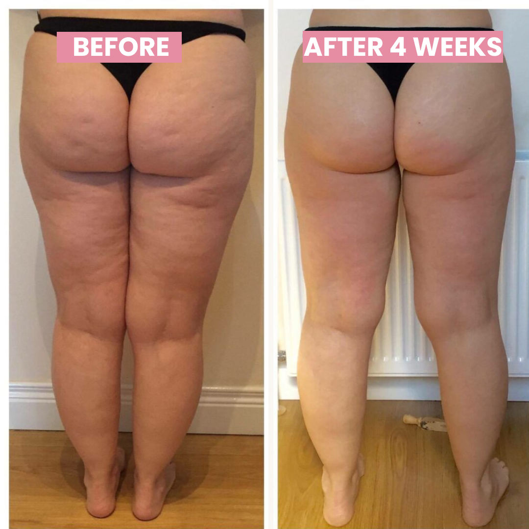 Body Contouring Cellulite Massager with Heat Therapy