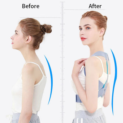 Adjustable Back Brace Posture Corrector - Customizable Back Support Belt for All-Day Comfort-4