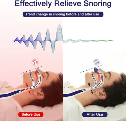 AeroSilk | Compact Portable Sleep Apnea Micro CPAP Device for Travel 3