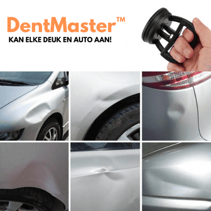 Advanced Car Dent Repair Kit - Fesara