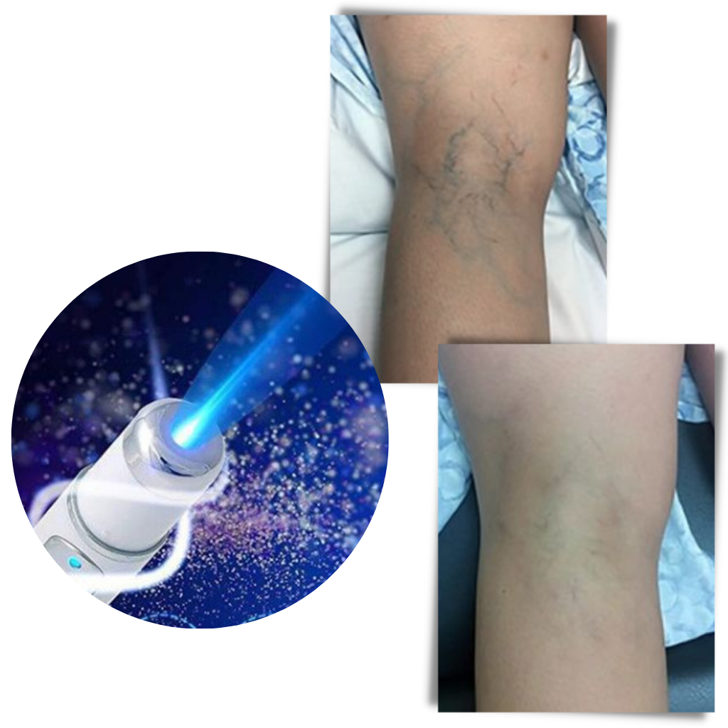 Portable Anti Aging Skin Care Pen