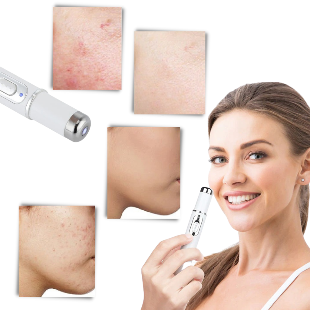 Portable Anti Aging Skin Care Pen