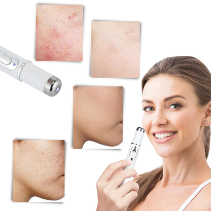 Portable Anti Aging Skin Care Pen