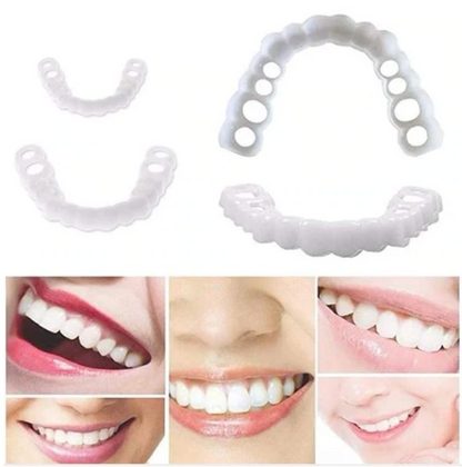 Bright Smile Dental Facet Kit