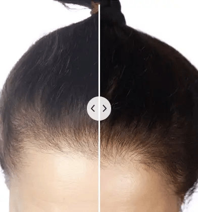 ChicBlend – 5-in-1 hair comb with massage and light therapy for healthier hair 4