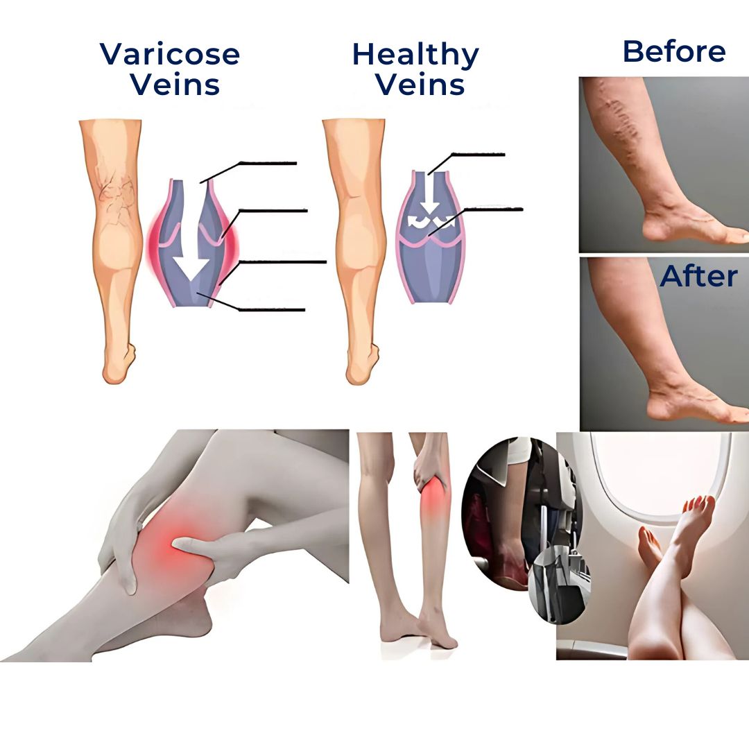 Comfortable Compression Socks for Foot Pain Relief - Fesara