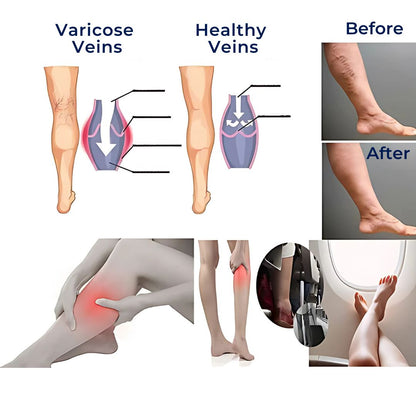 Comfortable Compression Socks for Foot Pain Relief - Fesara