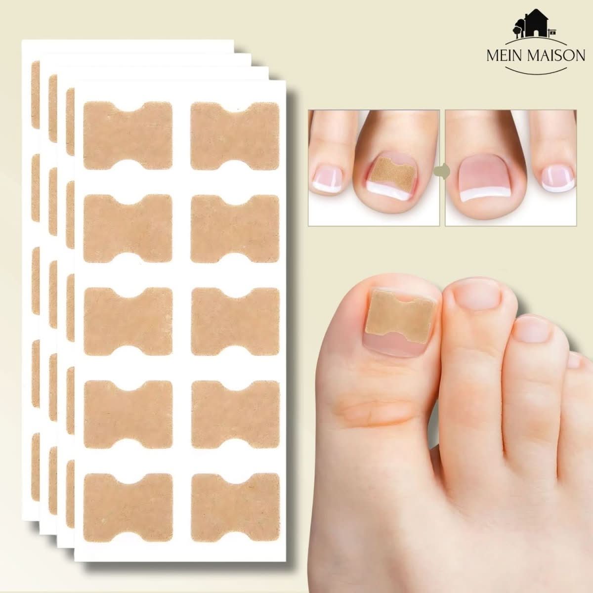 Easy Nail Fixer for Ingrown Toenail Pain Relief - Fesara