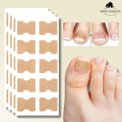 Easy Nail Fixer for Ingrown Toenail Pain Relief - Fesara