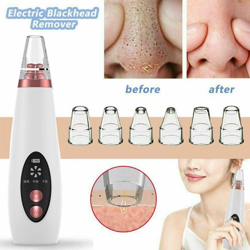 Fesara | Easy Pore Rechargeable Blackhead Cleaner Device
