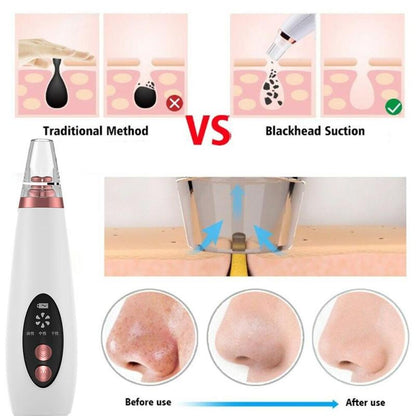 Fesara | Easy Pore Rechargeable Blackhead Cleaner Device