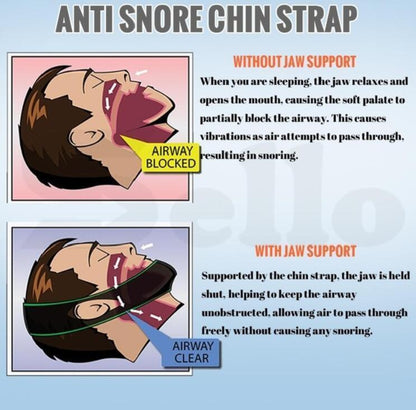 Sleep Aid Anti Snore Chin Strap Device