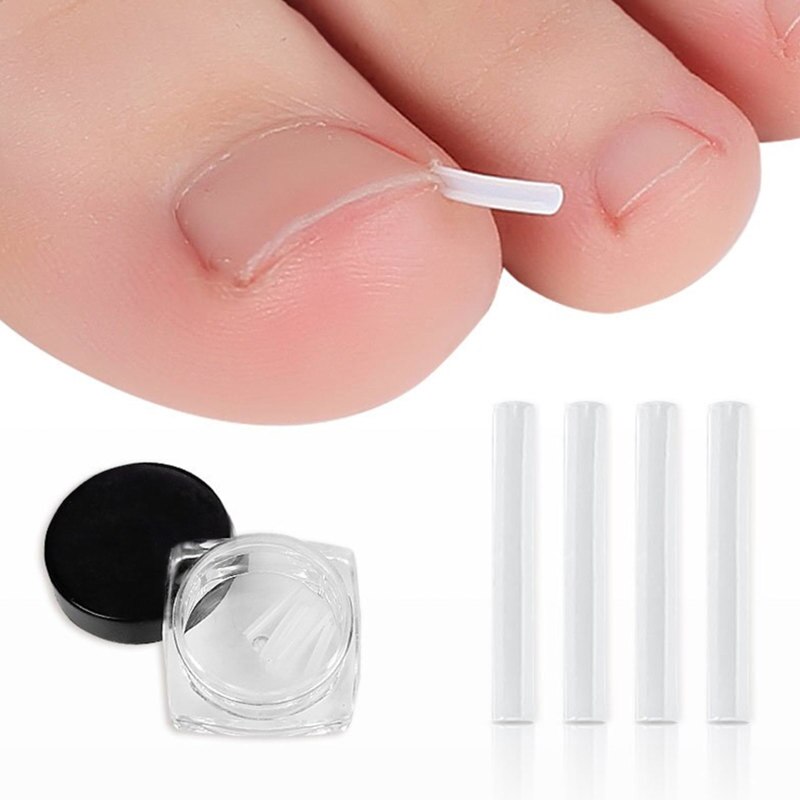 Comfort Toe Nail Care Protector - Fesara