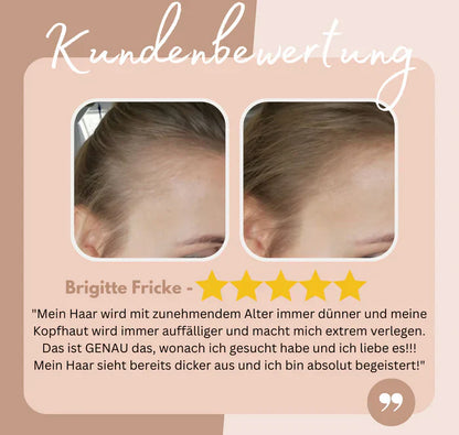 Easy Hairline Headband