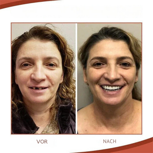 Comfortable Silicone Dental Prosthesis Set for Natural Smile - Fesara