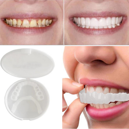 SimpleFit Snap-In Dental Plate