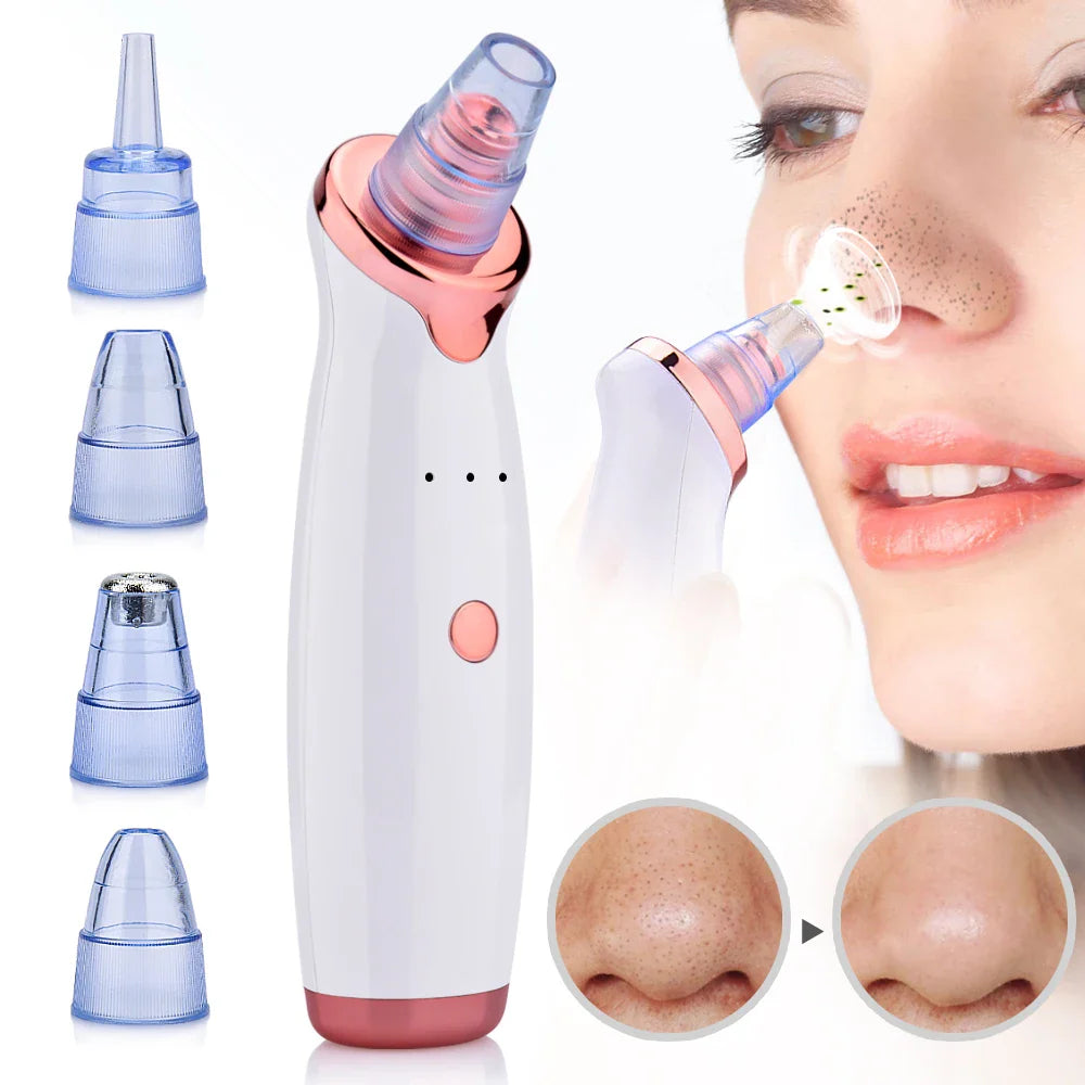 Pore Cleaner - Blackhead Removal Vacuum Tool - Fesara