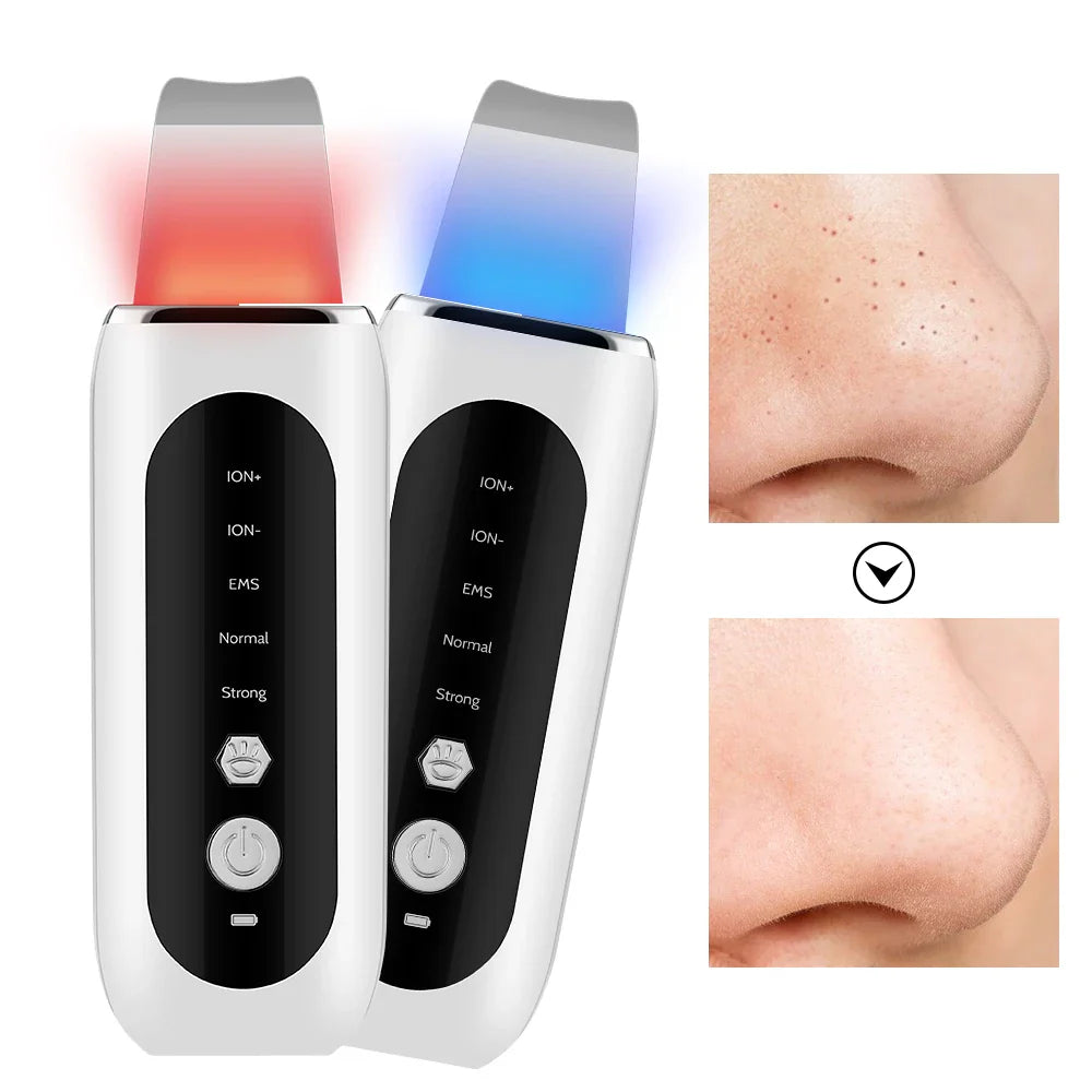 Deep Clean Facial Pore Minimizer & Blackhead Remover - Fesara