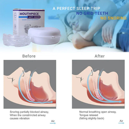 Snore Stopping Mouth Guard