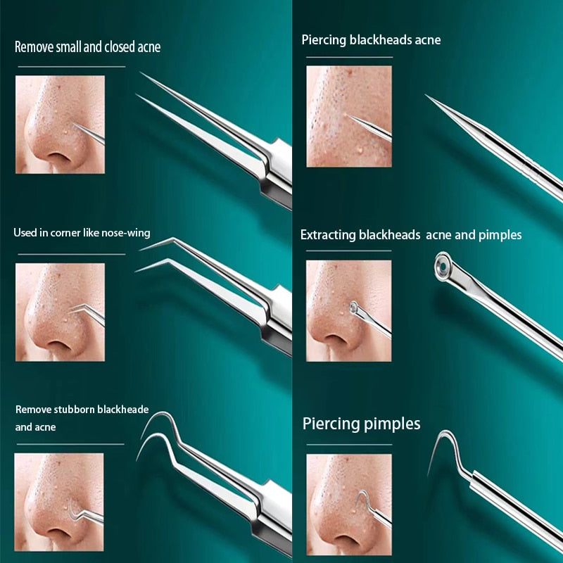 Acne Treatment Pore Cleansing Blackhead Removal Kit