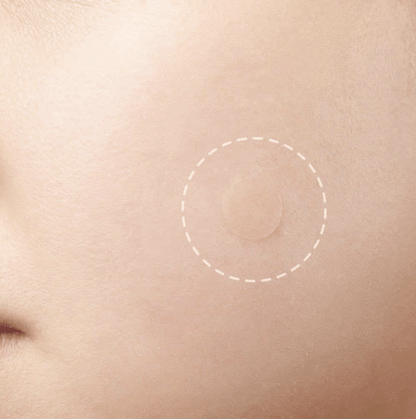 Fast Healing Pimple and Spot Patch - Fesara