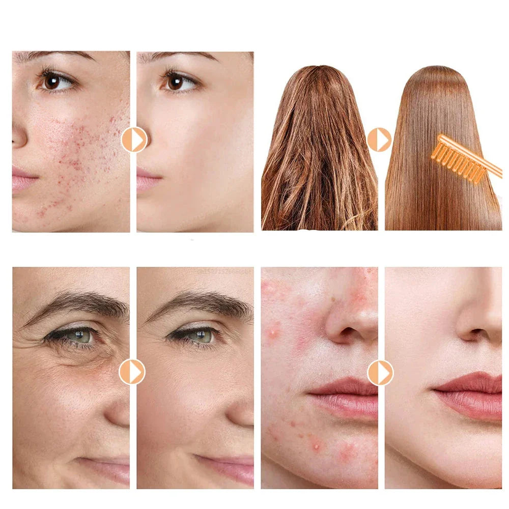 Advanced Anti Aging Facial Skin Wand