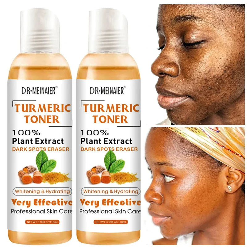 Natural Turmeric Toner with Vitamin C and Ginger Extract