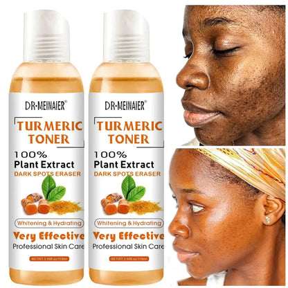 Natural Turmeric Toner with Vitamin C and Ginger Extract
