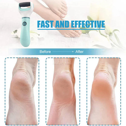 Rechargeable Foot Callus Remover for Dry Skin