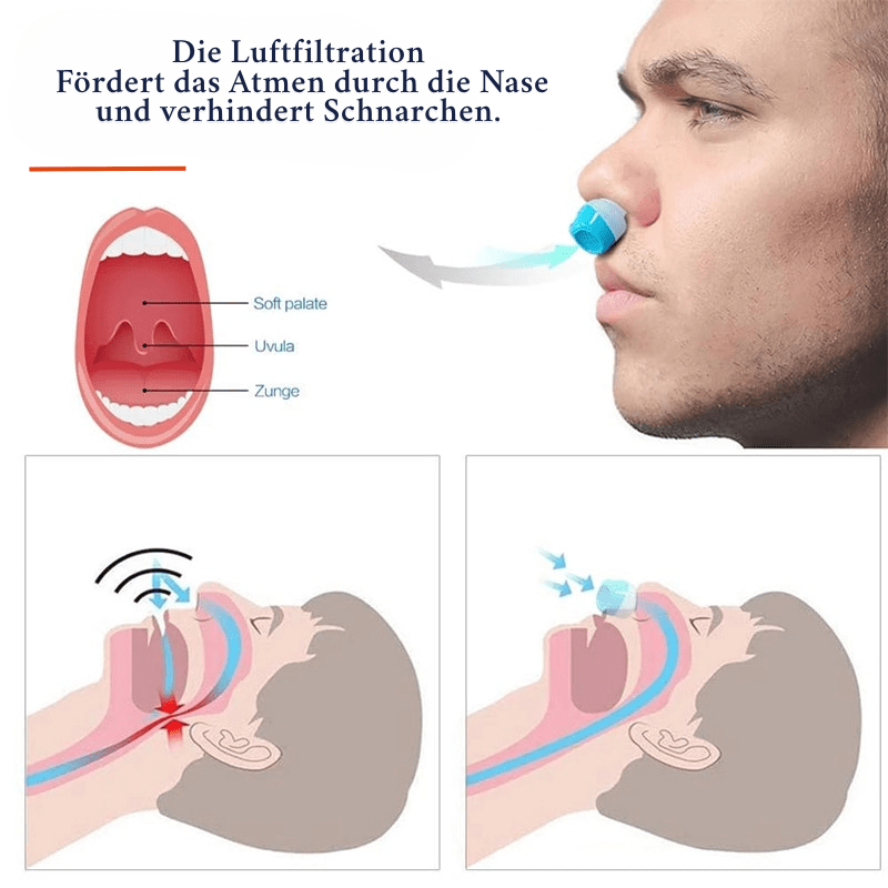 Sleeppure – Anti-Snoring Air Filter System for Better Sleep & Healthy Breathing 4