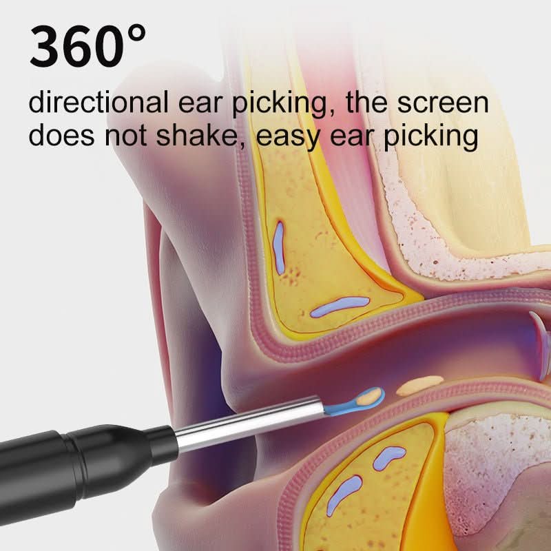 SmartView Mini – Compact tool for clear insights and precise observation 3