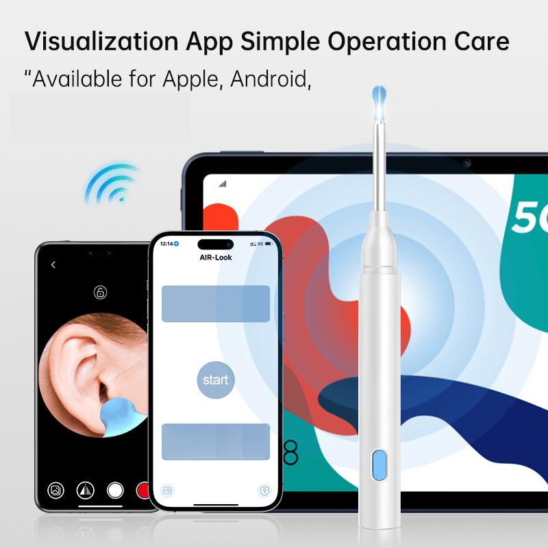 SmartView Mini – Compact tool for clear insights and precise observation 7
