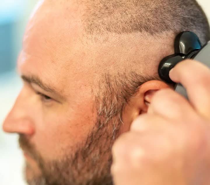 SmoothTrim – 5-in-1 Trimmer with Floating Shaving Heads & Accessories 5
