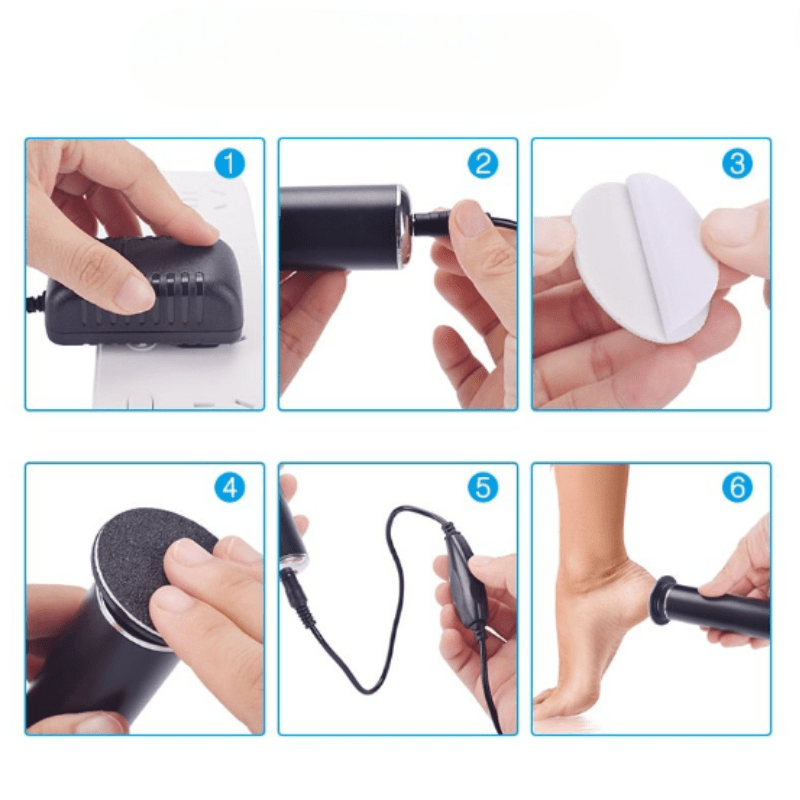 Smoothfeet – Electric pedicure file for gentle and effective foot care 7