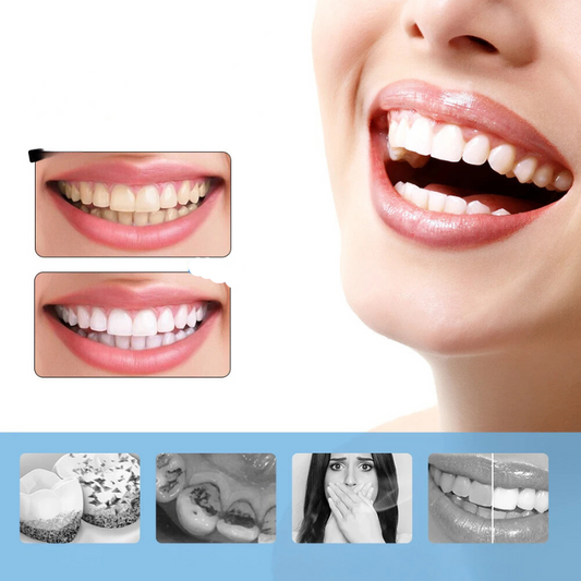 Professional 6-Speed Electric Teeth Whitening Kit - Fesara