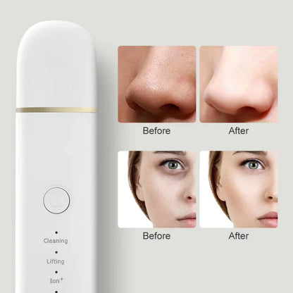 Exfoliating Face Brush for Deep Skin Cleansing