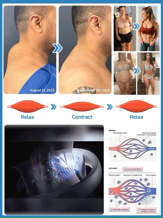 Professional Ultrasound Cellulite Reduction Machine